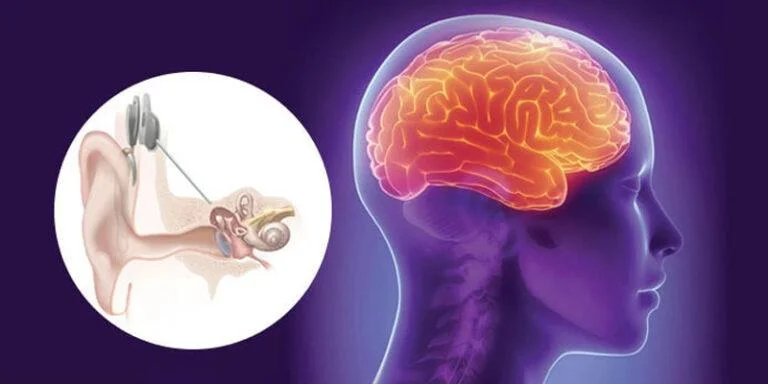 Why Brain-Friendly Hearing Aids Are So Important 2